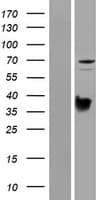 PRODH Protein (Over-Expression Lysate Myc-DDK (Flag))