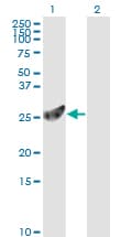 IHC-plus™ Monoclonal Mouse anti-Human PSMA7 Antibody (clone 1A10-3G12, IHC, IF, WB)