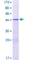 Human LOH12CR1 Protein (Recombinant GST)