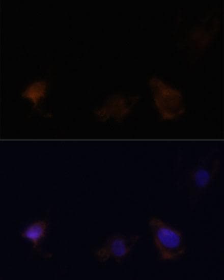 Polyclonal Rabbit anti-Human Zyxin Antibody (IHC, IF, WB)