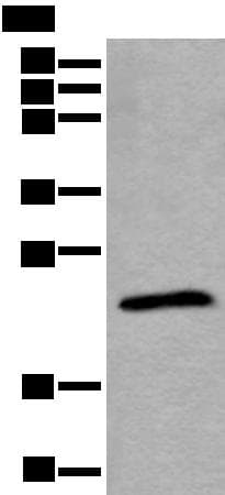 TPT1 / TCTP Antibody