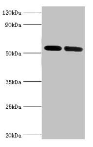 IHC-plus™ Polyclonal Rabbit anti-Human ATP6V1B1 Antibody (aa1-280, IHC, WB)