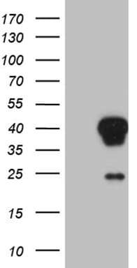 AEBP2 Antibody (clone OTI8G9, Carrier-free)