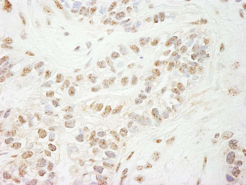KDM5B / JARID1B Antibody (aa1494-1544)