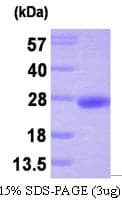 Human PTP4A3 Protein (Recombinant His)