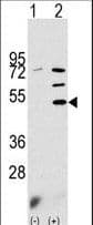 Polyclonal Rabbit anti-Human PDK3 Antibody (aa1-30, WB)