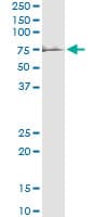 PROC / Protein C Antibody (clone 3A10)