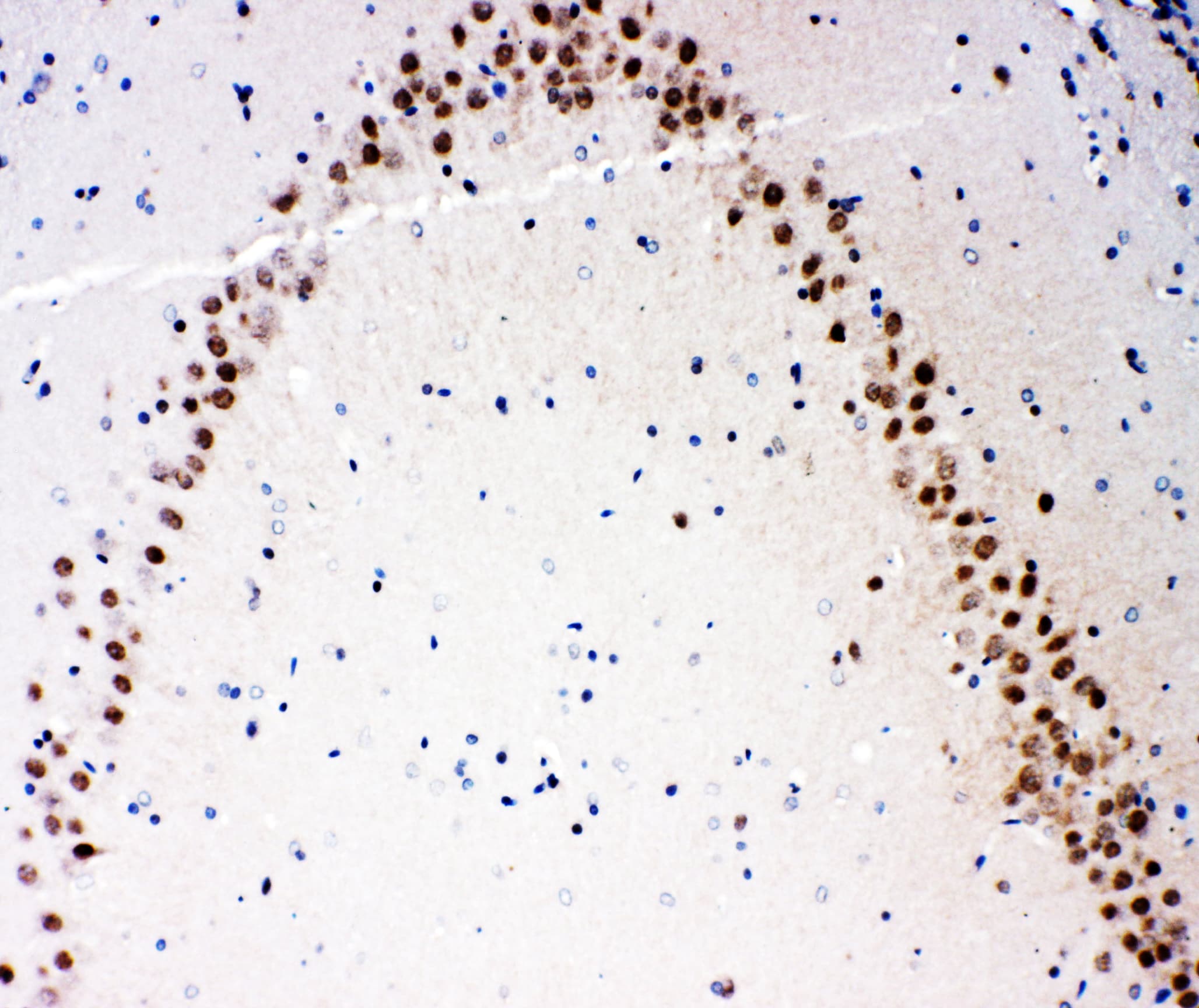 MAP3K3 / MEKK3 Antibody (aa11-25)
