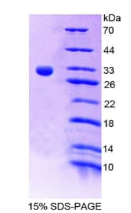 Mouse F13A1 / Factor XIIIa Protein (Recombinant His-T7)