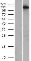 CCDC158 Protein (Over-Expression Lysate Myc-DDK (Flag))