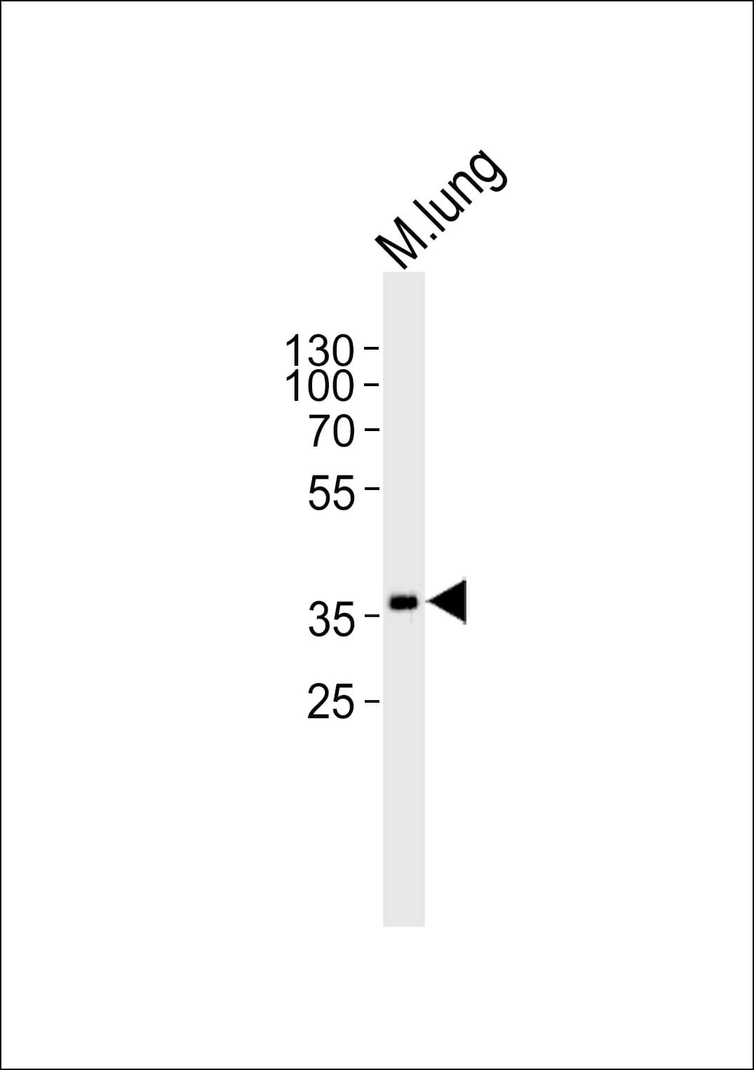 HOXA1 Antibody (aa191-219)