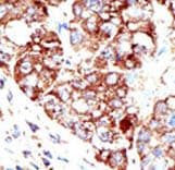 Polyclonal Rabbit anti-Human PIAS1 Antibody (aa607-637, IHC, WB)