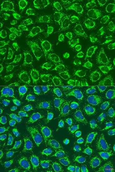 MAP4K5 Antibody