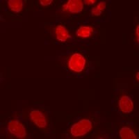 Polyclonal Rabbit anti-Human DDX21 Antibody (IHC, IF, WB)