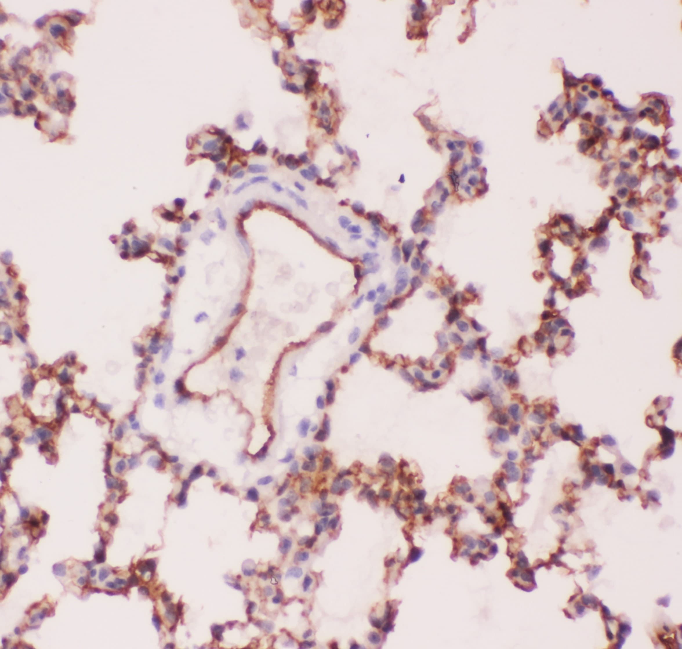 ACE / CD143 Antibody (aa651-864)