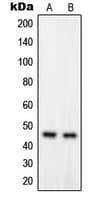 RAIG2 / GPRC5B Antibody (Internal)