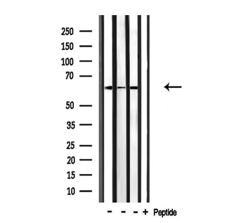 Polyclonal Rabbit anti-Human CDKAL1 Antibody (IF, WB)
