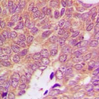 S100A16 Antibody (Internal)