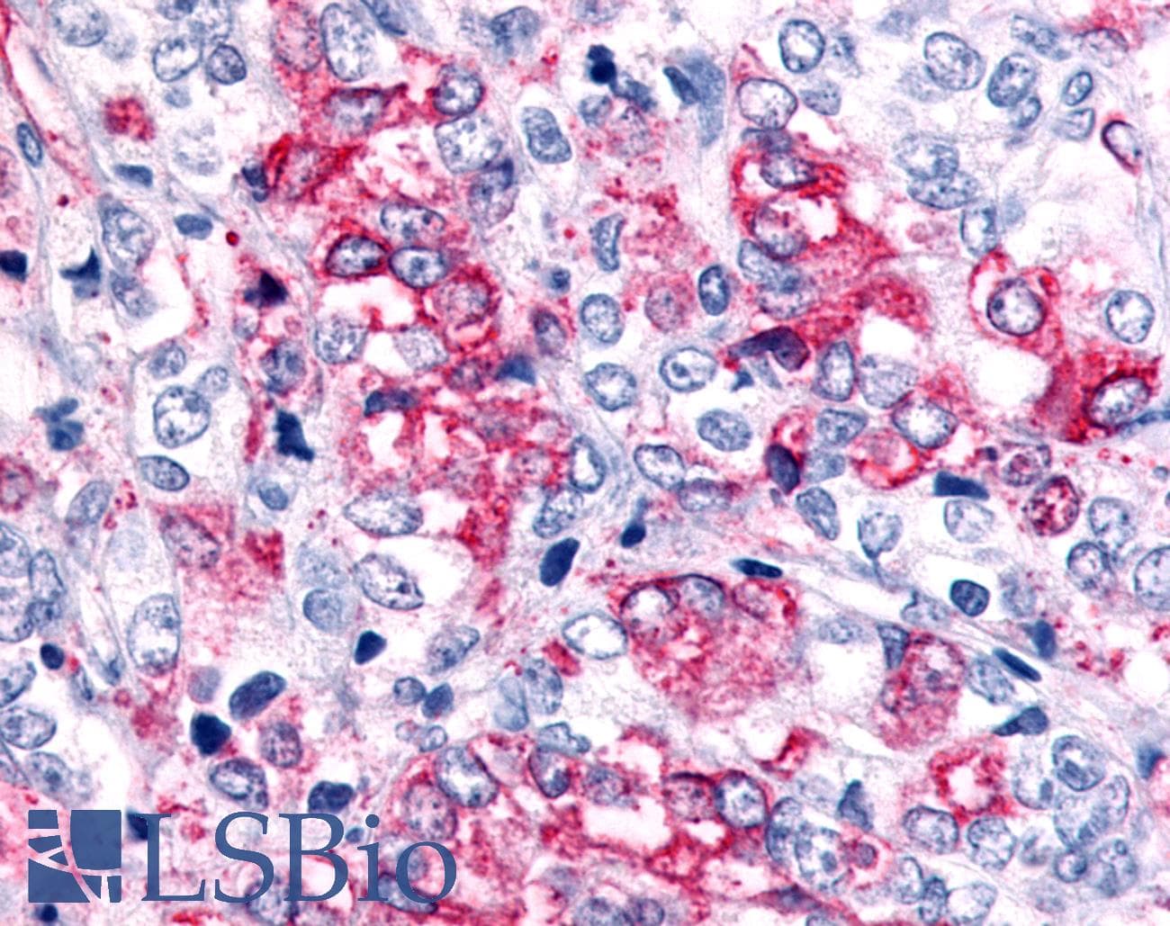 PathPlus™ Polyclonal Rabbit anti-Human GPR45 Antibody (Cytoplasmic Domain, IHC)
