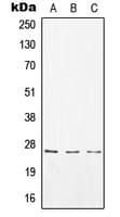 Polyclonal Rabbit anti-Human CD8A / CD8 Alpha Antibody (Internal, WB)
