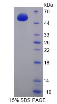 Mouse ADCY9 / Adenylate Cyclase 9 Protein (Recombinant His-GST-S)