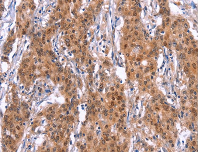 ADGRA2 / GPR124 Antibody