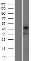 Human TNNT2 / CTNT Protein (Over-Expression Lysate Myc-DDK (Flag))