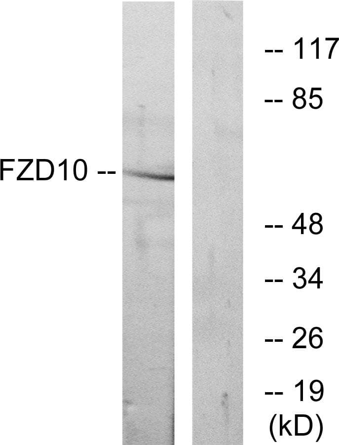 FZD10 / Frizzled 10 Antibody