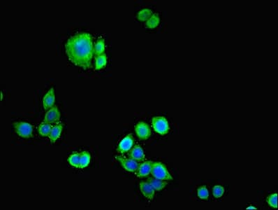 IHC-plus™ Polyclonal Rabbit anti-Human CDH12 / Cadherin 12 Antibody (IHC, WB)
