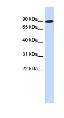 PGM2L1 Antibody (aa179-228)