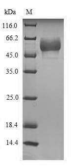 Human HTR3E / 5-HT3E Receptor Protein (Recombinant 6His-SUMO, N-terminus)
