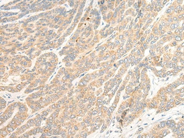 Polyclonal Rabbit anti-Human TTC4 Antibody (IHC)