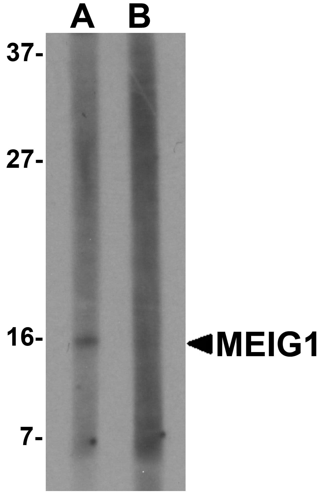 MEIG1 Antibody