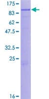 Human Complement C1s Protein (Recombinant GST)
