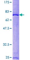 Human RCC1 Protein (Recombinant GST)