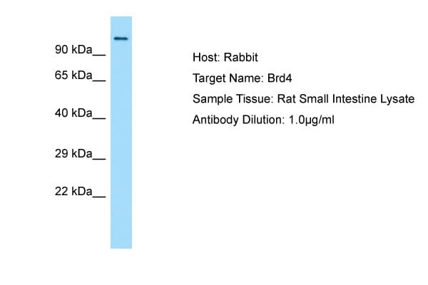 BRD4 Antibody (N-Terminus)