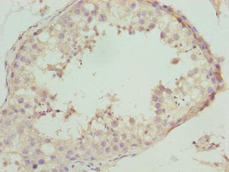 NBPF3 Antibody