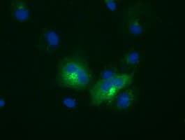 LIPG / Endothelial Lipase Antibody (clone OTI1E3)
