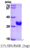 Human CRYBB1 Protein (Recombinant His)