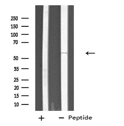 Polyclonal Rabbit anti-Human PGIS / PTGIS Antibody (IF, WB)