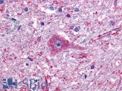 PathPlus™ GPR137B Antibody (Cytoplasmic Domain)