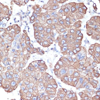 KRT18 / CK18 / Cytokeratin 18 Antibody