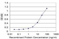 MAGEB1 Antibody (clone 2A4)
