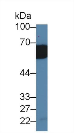 AcPL / IL18RAP Antibody (aa396-548)