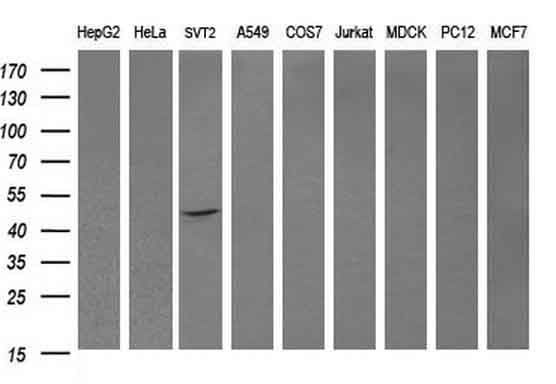 DOK7 Antibody (clone OTI1A9)