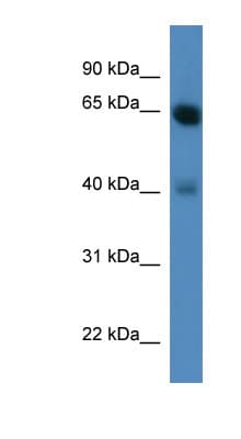 NTRK2 / TRKB Antibody (aa466-515)