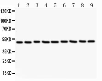 Polyclonal Rabbit anti-Human c-Src Kinase / CSK Antibody (aa2-204, IHC, WB)