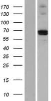 MMP21 Protein (Over-Expression Lysate Myc-DDK (Flag))