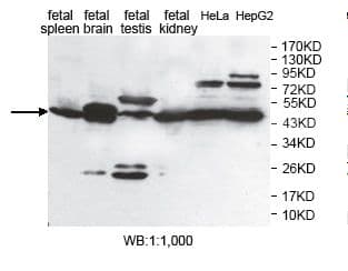 Polyclonal Rabbit anti-Human ENO2 / NSE Antibody (aa23-200, IHC, WB)