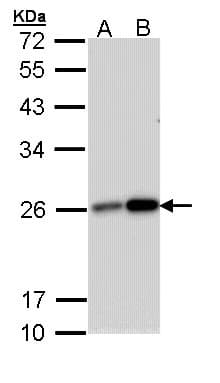 MGMT Antibody